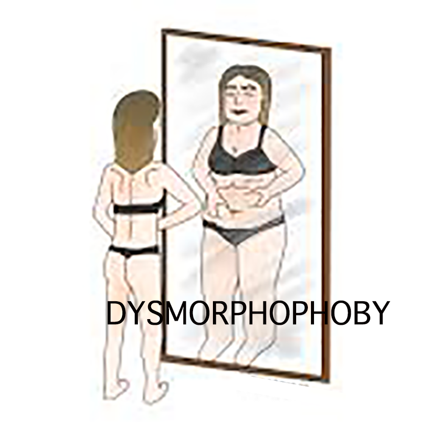 dysmorphophoby